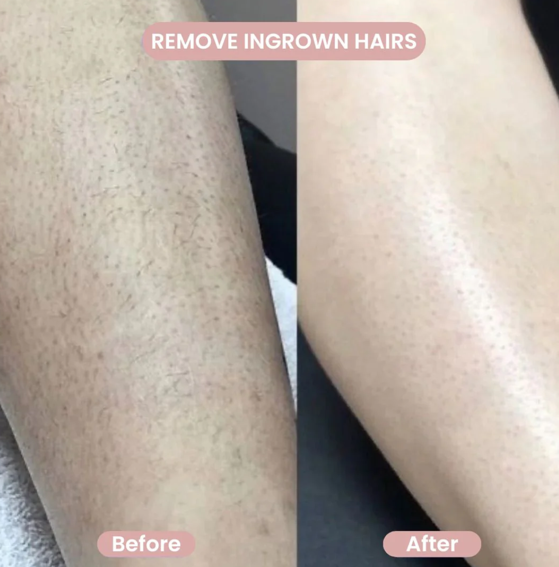 SmoothShave